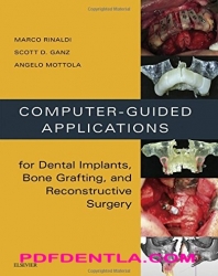 Computer-Guided Applications for Dental Implants, Bone Grafting, and Reconstructive Surgery (pdf)